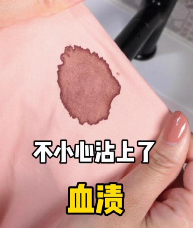 用来洗脸祛痘其实它还有很多隐藏用法J9国际集团超市2元硫磺皂别只知道(图9)